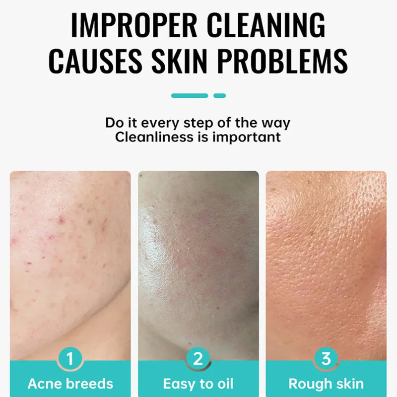 Crème pour le visage à l'acide salicylique, élimination de l'acné, contrôle de l'huile, rétrécit les Pores, éclaircit les marques d'acné, Gel de mélanine, soins pour la peau lisses, beauté coréenne 30g