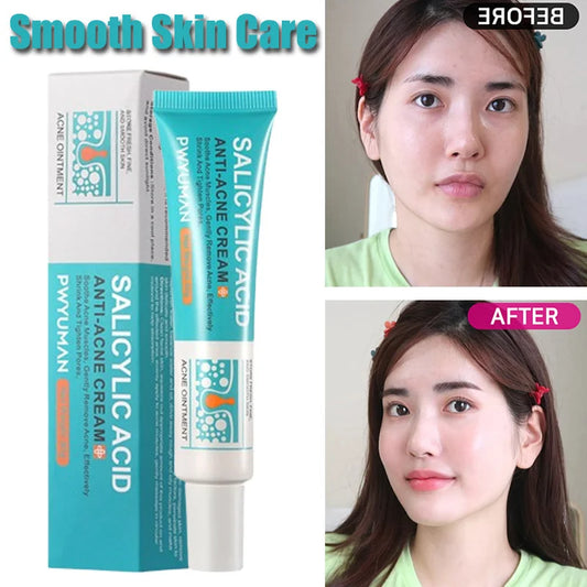 Crème pour le visage à l'acide salicylique, élimination de l'acné, contrôle de l'huile, rétrécit les Pores, éclaircit les marques d'acné, Gel de mélanine, soins pour la peau lisses, beauté coréenne 30g