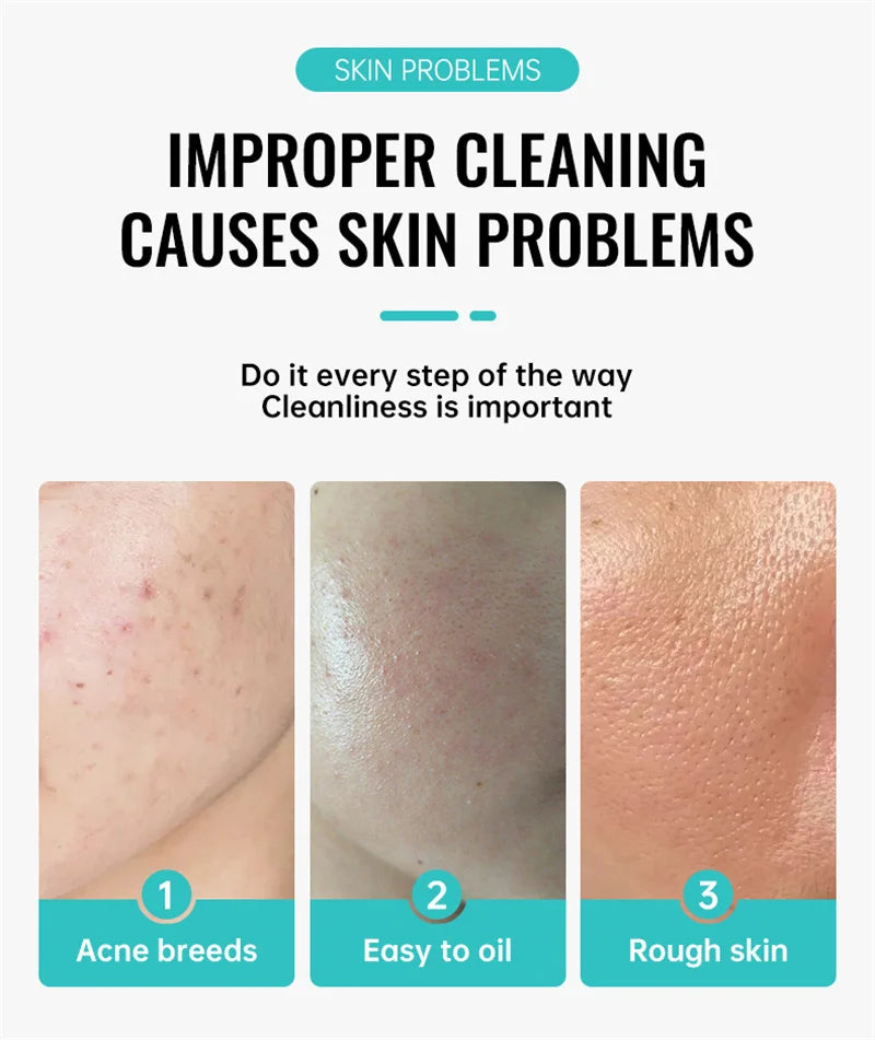 Crème pour le visage à l'acide salicylique, élimination de l'acné, contrôle de l'huile, rétrécit les Pores, éclaircit les marques d'acné, Gel de mélanine, soins pour la peau lisses, beauté coréenne 30g