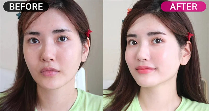 Crème pour le visage à l'acide salicylique, élimination de l'acné, contrôle de l'huile, rétrécit les Pores, éclaircit les marques d'acné, Gel de mélanine, soins pour la peau lisses, beauté coréenne 30g